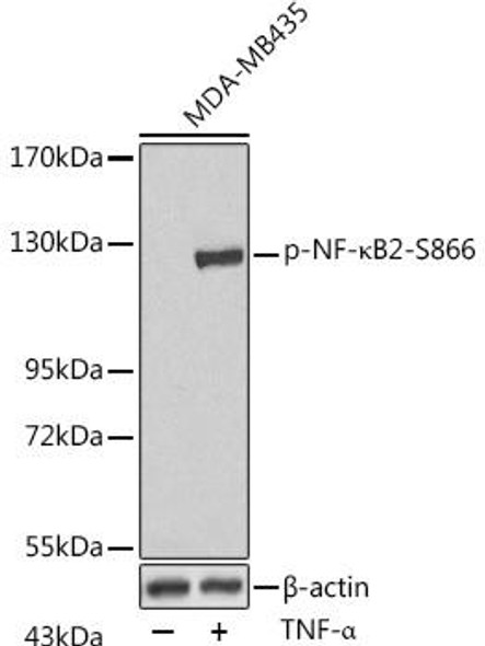 Cell Biology Antibodies 16 Anti-Phospho-NFKB2-S866 Antibody CABP0418