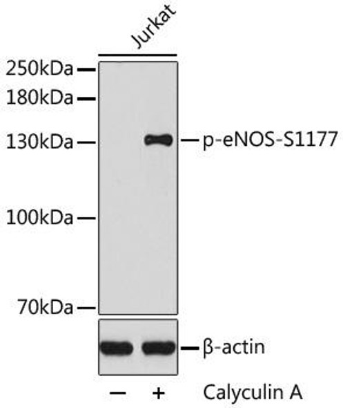 Cell Biology Antibodies 16 Anti-Phospho-NOS3-S1177 Antibody CABP0421