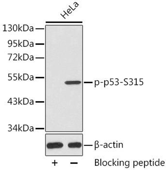 Cell Death Antibodies 2 Anti-Phospho-TP53-S315 Antibody CABP0462