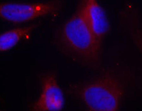 Immunology Antibodies 3 Anti-Phospho-ZAP70-Y319 Antibody CABP0467