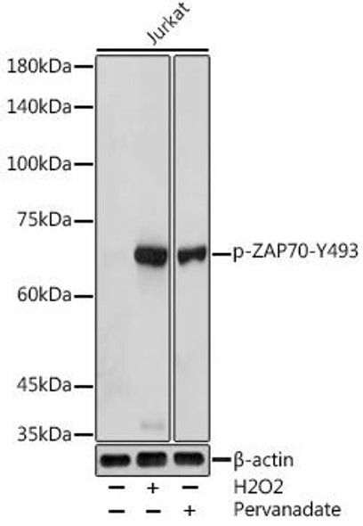 Immunology Antibodies 3 Anti-Phospho-ZAP70-Y493 Antibody CABP0468