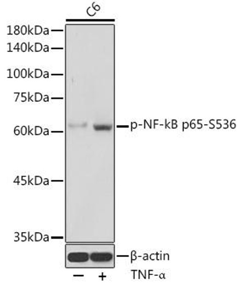 Immunology Antibodies 3 Anti-Phospho-RELA-S536 Antibody CABP0475