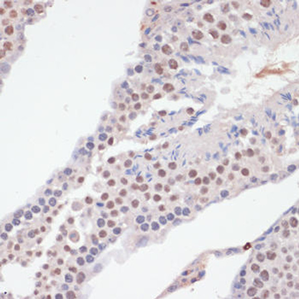 Immunology Antibodies 3 Anti-Phospho-RELA-S536 Antibody CABP0475
