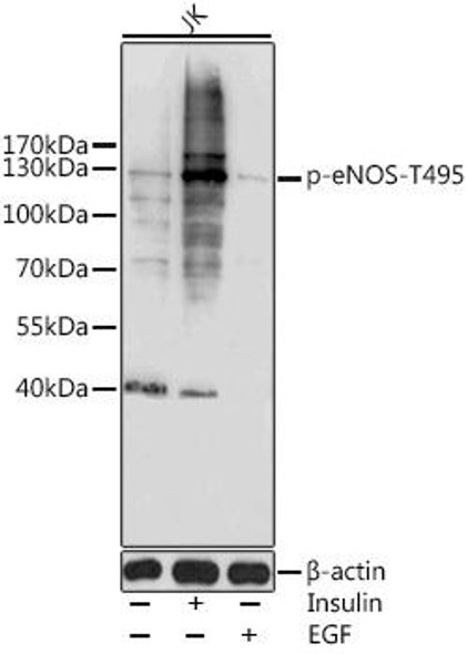 Cell Biology Antibodies 16 Anti-Phospho-eNOS-T495 Antibody CABP0516