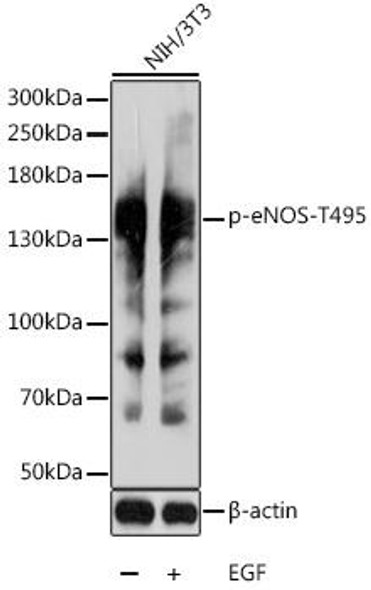 Cell Biology Antibodies 16 Anti-Phospho-eNOS-T495 Antibody CABP0516