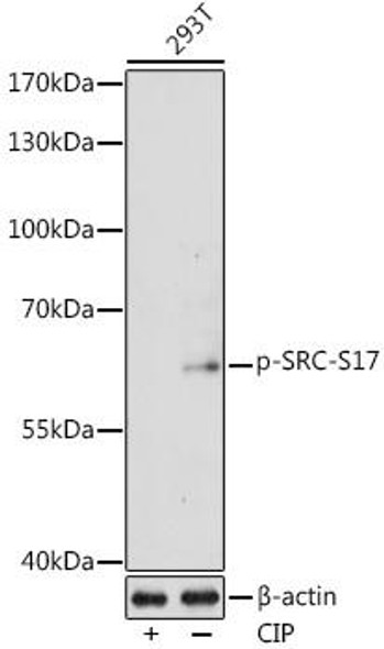 Cell Biology Antibodies 16 Anti-Phospho-SRC-S17 Antibody CABP0522