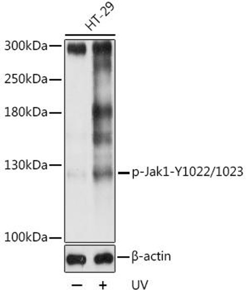 Cell Biology Antibodies 16 Anti-Phospho-Jak1-Y1022/1023 Antibody CABP0530