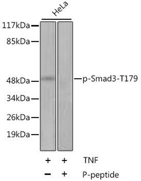 Immunology Antibodies 3 Anti-Phospho-SMAD3-T179 Antibody CABP0554