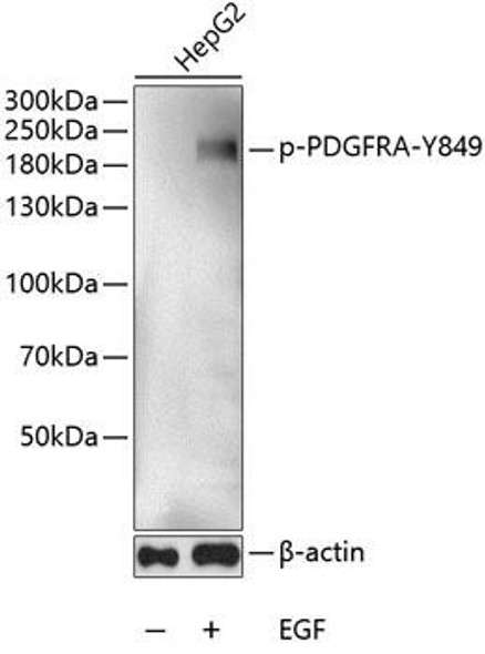 Cell Biology Antibodies 16 Anti-Phospho-PDGFRA-Y849 Antibody CABP0569