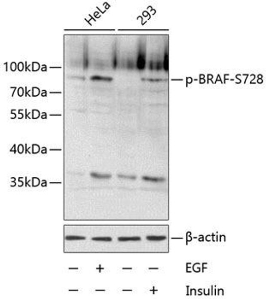 Cell Biology Antibodies 16 Anti-Phospho-BRAF-S728 Antibody CABP0576