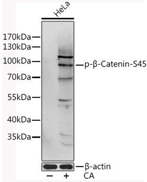 Cell Biology Antibodies 16 Anti-Phospho-CTNNB1-S45 Antibody CABP0580