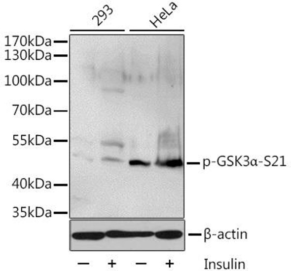 Metabolism Antibodies 3 Anti-Phospho-GSK3A-S21 Antibody CABP0582