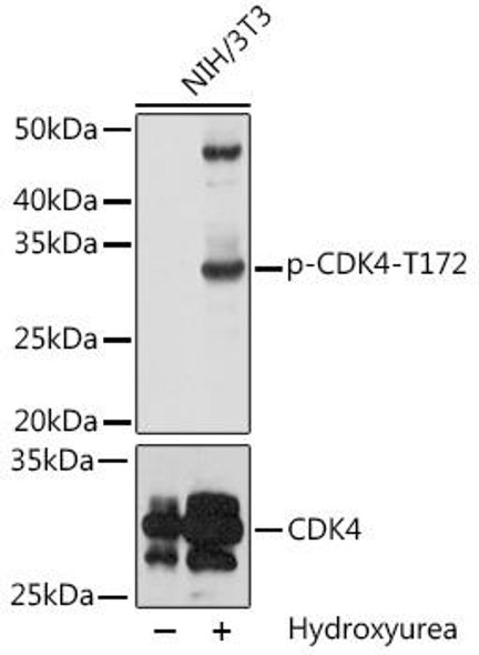 Cell Cycle Antibodies 2 Anti-Phospho-CDK4-T172 Antibody CABP0593