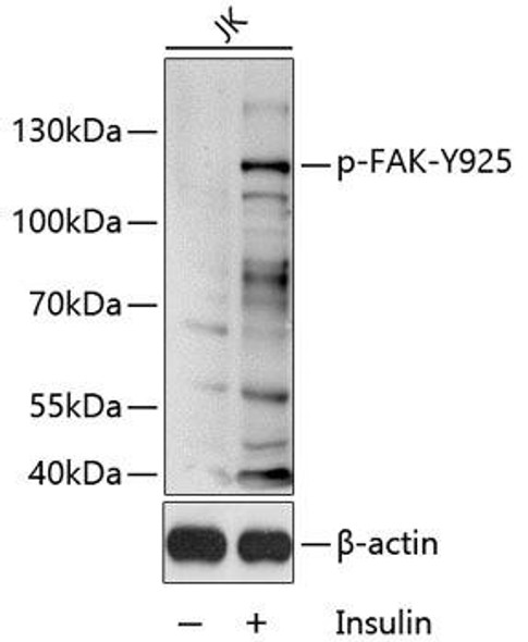 Cardiovascular Antibodies Anti-Phospho-PTK2-Y925 Antibody CABP0599