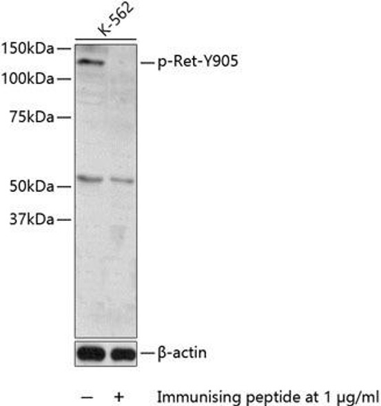 Cell Biology Antibodies 16 Anti-Phospho-Ret-Y905 Antibody CABP0600