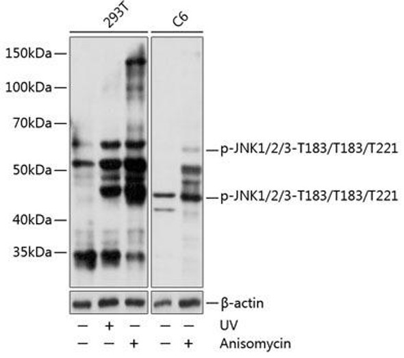 Cell Biology Antibodies 16 Anti-Phospho-JNK1/2/3-T183/T183/T221 mAb Antibody CABP0631