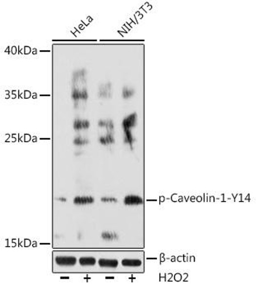 Immunology Antibodies 3 Anti-Phospho-CAV1-Y14 Antibody CABP0742