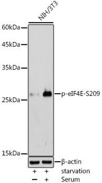 ChIP Antibodies Anti-Phospho-eIF4E-S209 Antibody CABP0747