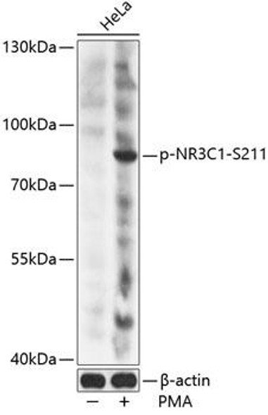 Cell Death Antibodies 2 Anti-Phospho-NR3C1-S211 pAb Antibody CABP0759
