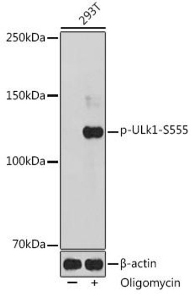 Autophagy Antibodies Anti-Phospho-ULk1-S555 pAb Antibody CABP0760