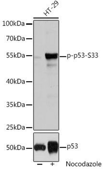Cell Death Antibodies 2 Anti-Phospho-TP53-S33 pAb Antibody CABP0762