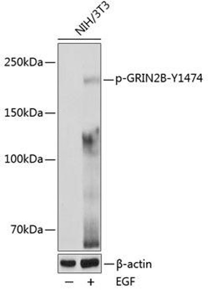 Signal Transduction Antibodies 3 Anti-Phospho-GRIN2B-Y1474 pAb Antibody CABP0771