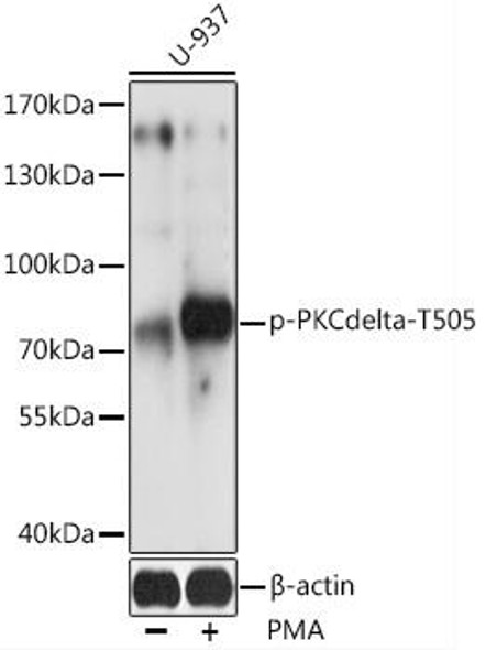 Cell Death Antibodies 2 Anti-Phospho-PRKCD-T505 pAb Antibody CABP0776