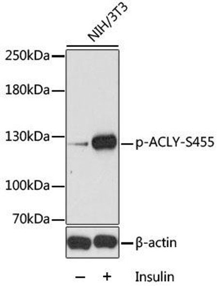 Metabolism Antibodies 3 Anti-Phospho-ACLY-S455 pAb Antibody CABP0779