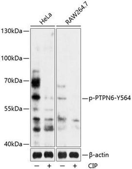 Cell Biology Antibodies 16 Anti-Phospho-PTPN6-Y564 pAb Antibody CABP0787