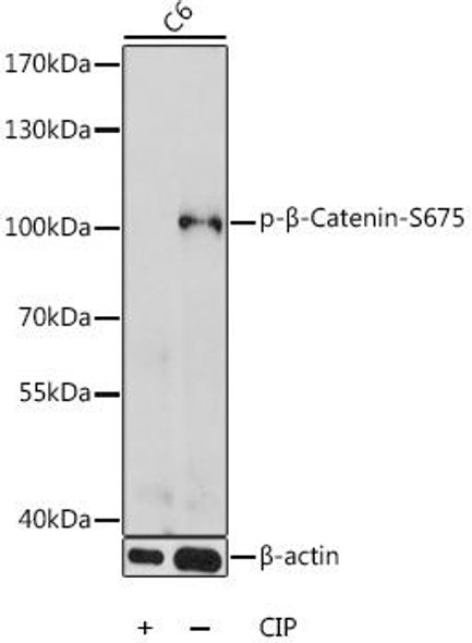 Cell Biology Antibodies 16 Anti-Phospho-CTNNB1-S675 pAb Antibody CABP0795