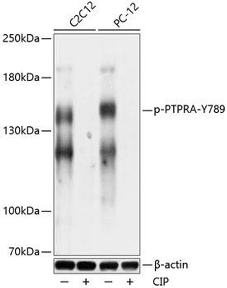 Cell Biology Antibodies 16 Anti-Phospho-PTPRA-Y789 pAb Antibody CABP0814