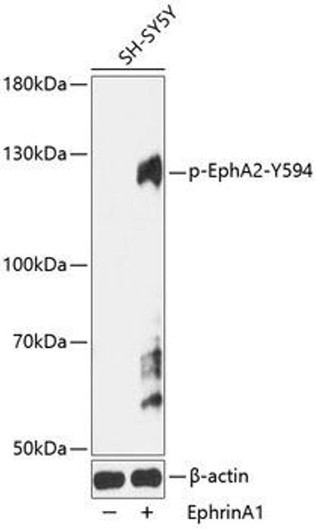 Cardiovascular Antibodies Anti-Phospho-EphA2-Y594 pAb Antibody CABP0818