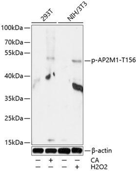 Cell Biology Antibodies 16 Anti-Phospho-AP2M1-T156 pAb Antibody CABP0823