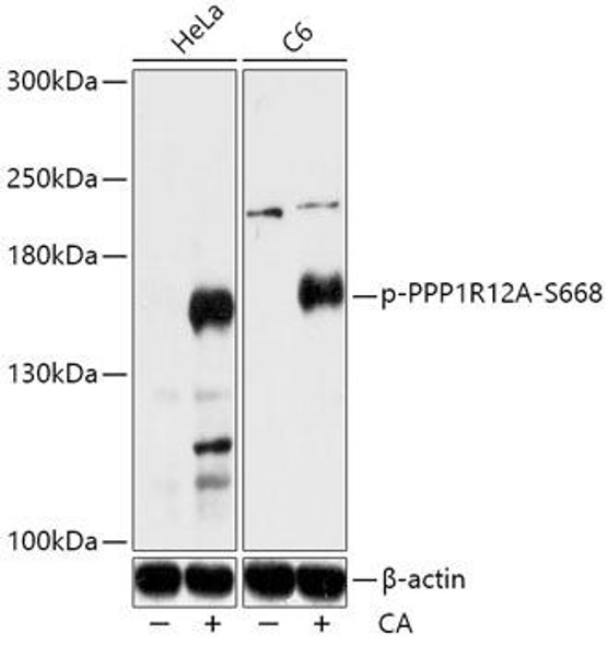 Cell Biology Antibodies 16 Anti-Phospho-PPP1R12A-S668 pAb Antibody CABP0835