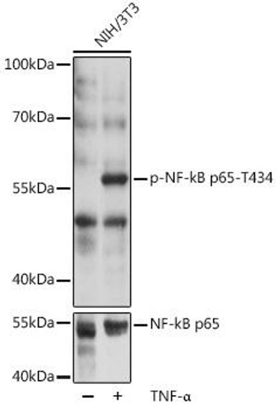 Immunology Antibodies 3 Anti-Phospho-RELA-T435 pAb Antibody CABP0838