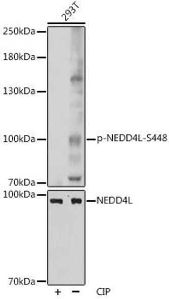 Developmental Biology Anti-Phospho-NEDD4L-S448 pAb Antibody CABP0843