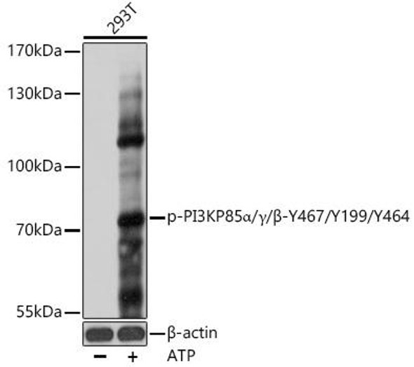 Cell Biology Antibodies 16 Anti-Phospho-PI3KP85 alpha/gamma/beta-Y467/Y199/Y464 pAb Antibody CABP0854