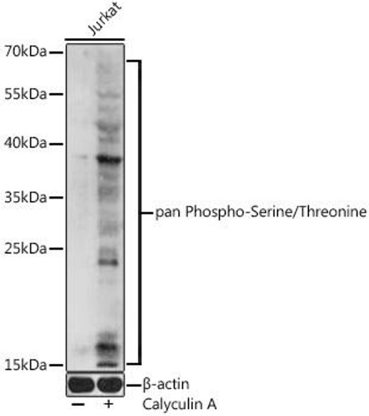 Cell Biology Antibodies 16 Anti-Phospho-Ser/Thr pAb Antibody CABP0893