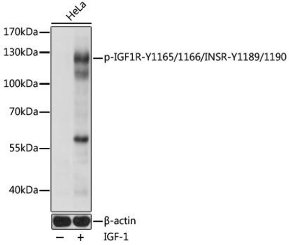 Cell Biology Antibodies 16 Anti-Phospho-IGF1R-Y1165/1166/INSR-Y1189/1190 pAb Antibody CABP0902
