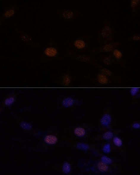 Epigenetics and Nuclear Signaling Antibodies 5 Anti-citrulline-Histone H3-R2/R8/R17 Antibody CAB18298