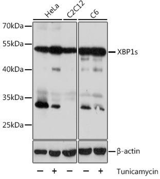 Cardiovascular Antibodies Anti-XBP1s Antibody CAB17007