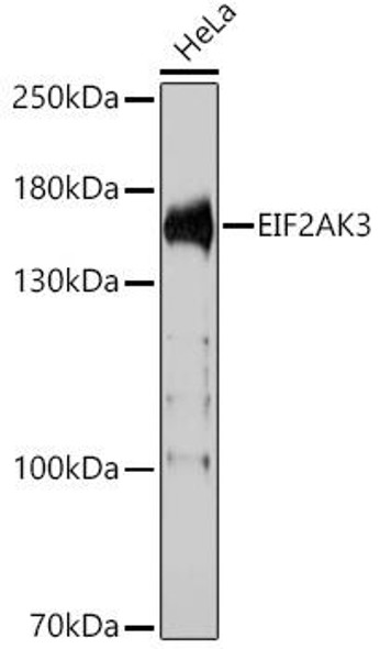 Metabolism Antibodies 3 Anti-EIF2AK3 Antibody CAB18196