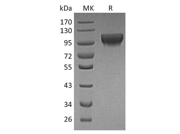 Human HER4/ErbB4 Recombinant Protein (RPES0105)