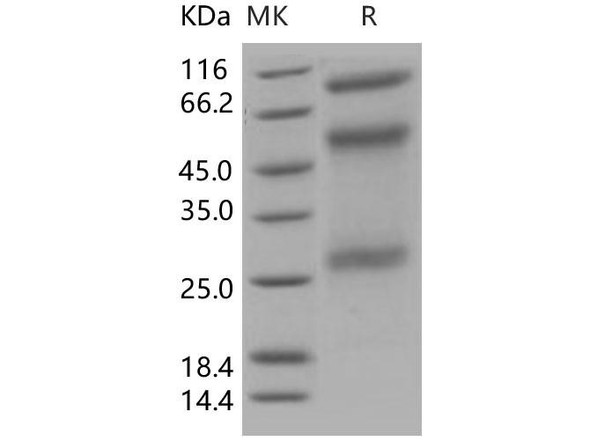 Human ADAM12 Recombinant Protein (RPES0110)