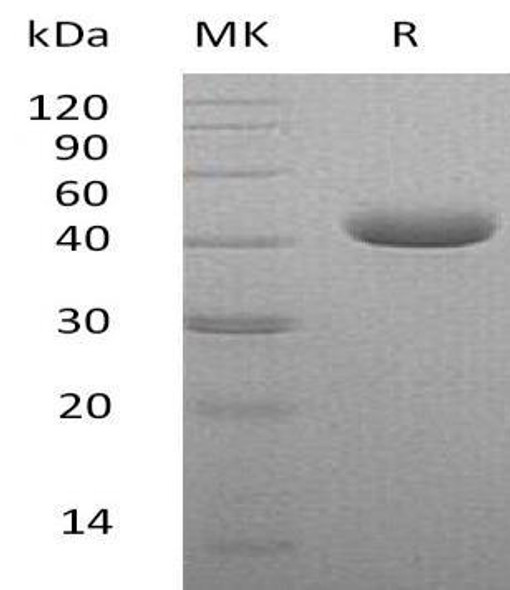 Human Nectin-4/NECTIN4 Recombinant Protein (RPES0140)