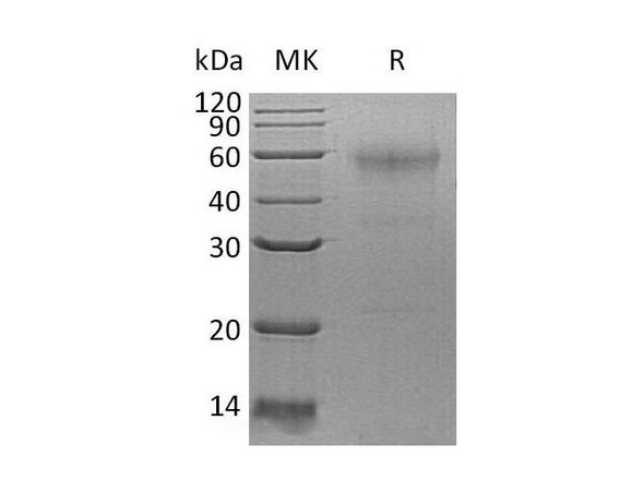 Human SPESP1 Recombinant Protein (RPES0141)