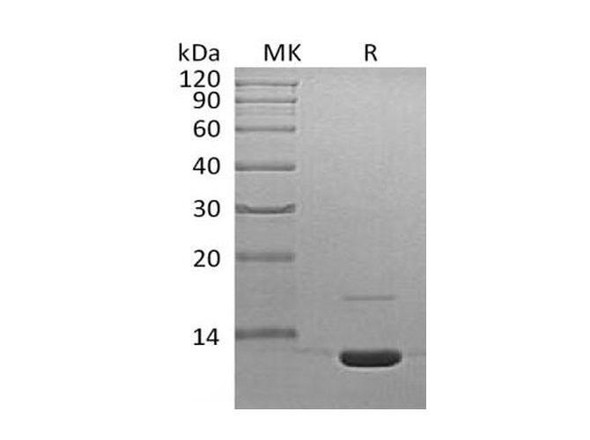 Mouse Complement C3a Recombinant Protein (RPES0143)