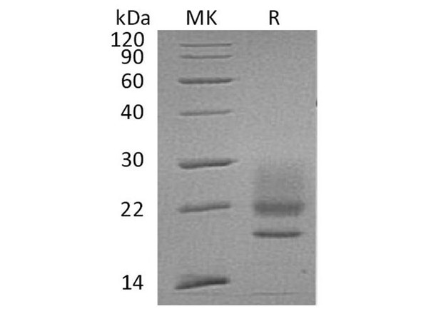 Human CD83/HB15 Recombinant Protein (RPES0159)