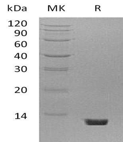 Mouse Complement C5 Recombinant Protein (RPES0164)