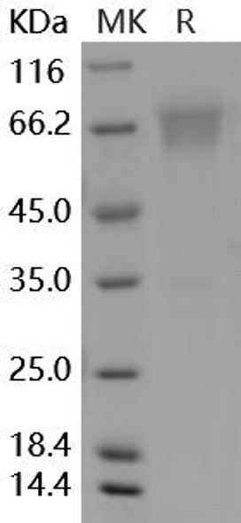 Mouse B7-H4/VTCN1 Recombinant Protein (RPES0178)